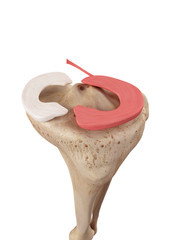 medical accurate illustration of the lateral miniscus