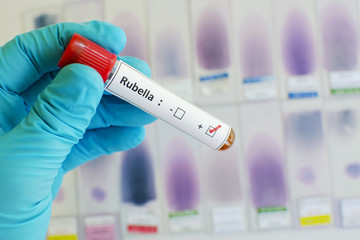 Fototapeta premium Rubella virus positive