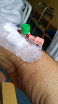 Infusionsnadel in einer Vene am Arm