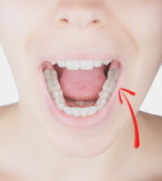 Denti bianchi bocca aperta
