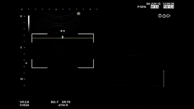 4D high quality ultrasound echography check. Gynecological medical examination. 33 weeks old pregnancy with 4D fetus rendering check, high definition 1080p