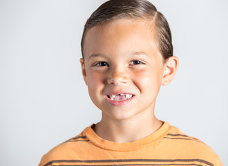 Child showing missing teeth.