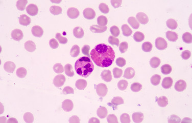 White blood cells of a human, photomicrograph panorama as seen u