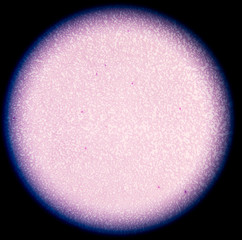 A blood smear is often used as a follow-up test to abnormal resu