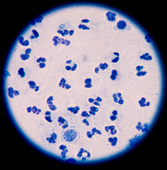Slide sputum AFB.