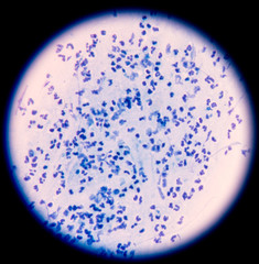 Slide sputum AFB.