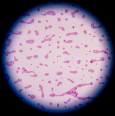 White blood cells of a human, photomicrograph panorama as seen u