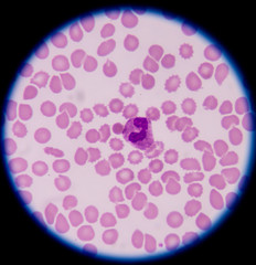 White blood cells of a human, photomicrograph panorama as seen u