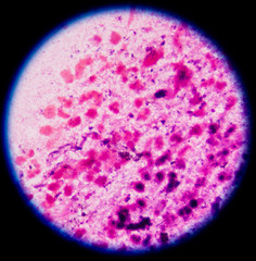 bacteria in sputum gram stain.