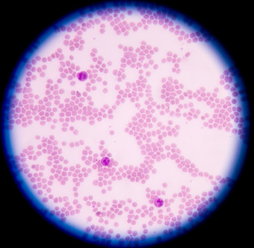 White blood cells of a human, photomicrograph panorama as seen u