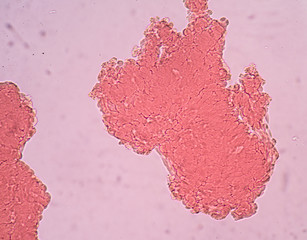 red blood cells agglutination.