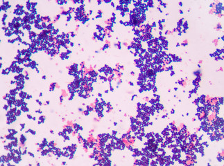 Gram staining, also called Gram's method, is a method of differe