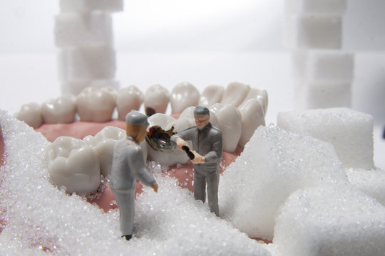 Karies Baustelle Zahn