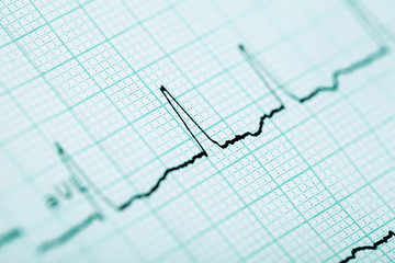 ECG background