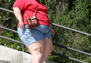 Obesity - A very overweight female walking in tight clothes.