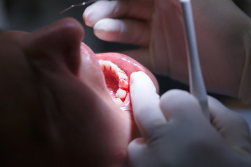 Patient at dental hygienists office