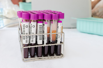 Medical test-tube with blood samples.