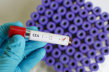 Obraz premium CEA positive