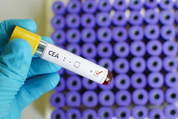 Obraz premium CEA positive
