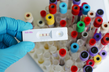 Fototapeta premium Anti-HBs (Hepatitis B antibody) positive