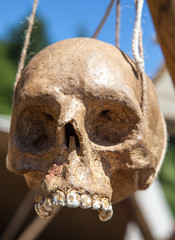 Human skull