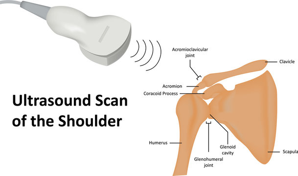 Ultrasound Scan of Shoulder