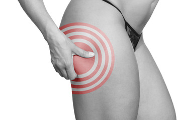 Cellulite am Oberschenkel - Schwarzweiß mit roter Markeirung