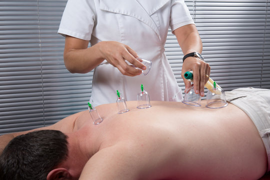 Cupping therapy, spa, woman doctor removes cups from the patient's back