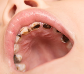 Obraz premium caries
