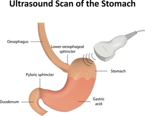 Ultrasound Scan of the Stomach - obrazy, fototapety, plakaty