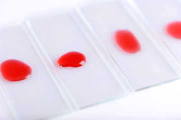 Laboratory analysis of blood close up