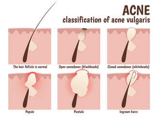 structure of the hair follicle
