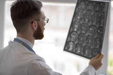 Doctor holding brain mri