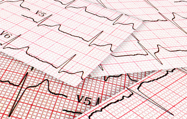 Charts of cardiograms by CU