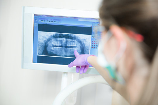 Dentist explaining x ray picture to patient