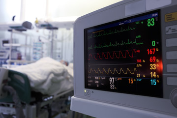 Clock monitoring of patients in ICU