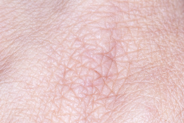 Human Skin