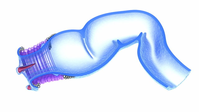 Hemorrhoids : Anal disorders, xray view
