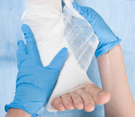 bandaged leg plaster in hospital