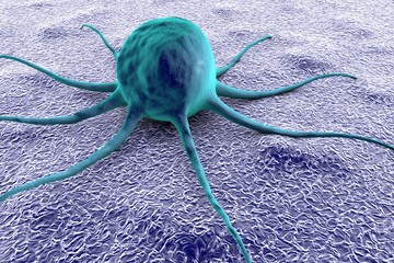 Digital illustration of a tumor cell, cancer cell on the surface of epithelium, organ, tissue, pathological cell, medical background, biology background, scientific background, microscopic view © Dr_Microbe