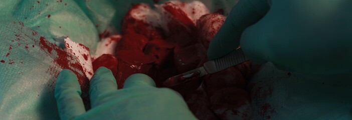 Surgeon during operation holding a scalpel