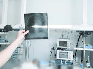 Doctor examines an x-ray picture of the patient