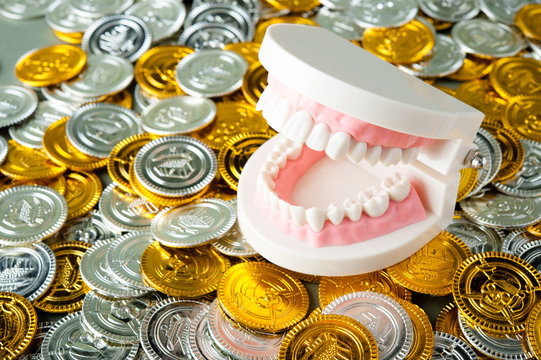 歯の健康とお金