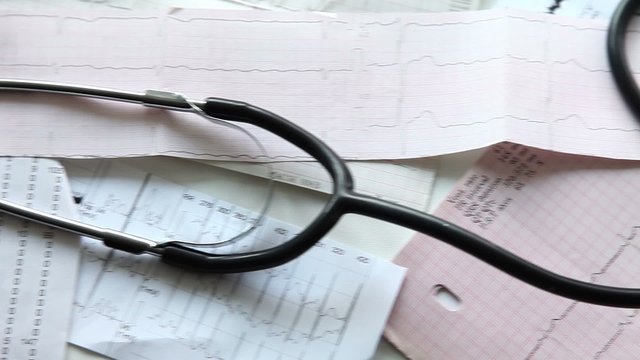 Stethoscope lying on a background of cardiogram. Tracking shot .
