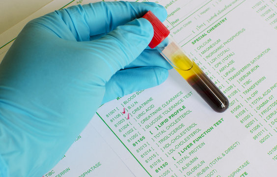Renal function test 