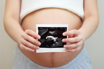 Pregnant Woman Holding Ultrasound Scan Photo