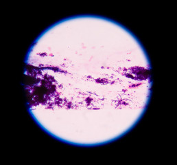 Gram staining, also called Gram's method, is a method of differe