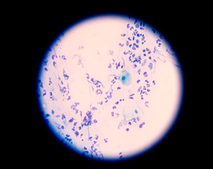 Slide sputum AFB.