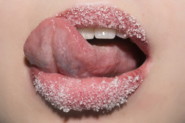 Sugar lips