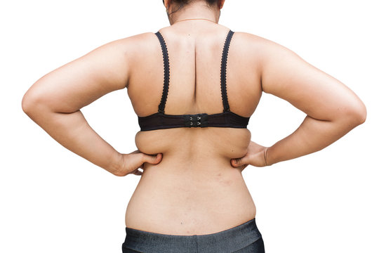 Obese Women Show More Fatty Parts  From Rear